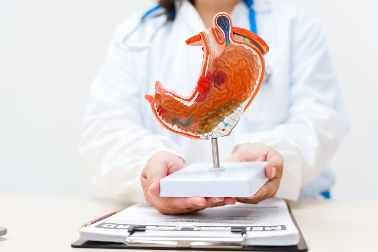 ¿Es realmente gastritis o algo peor? Reconoce estas señales que envía tu cuerpo