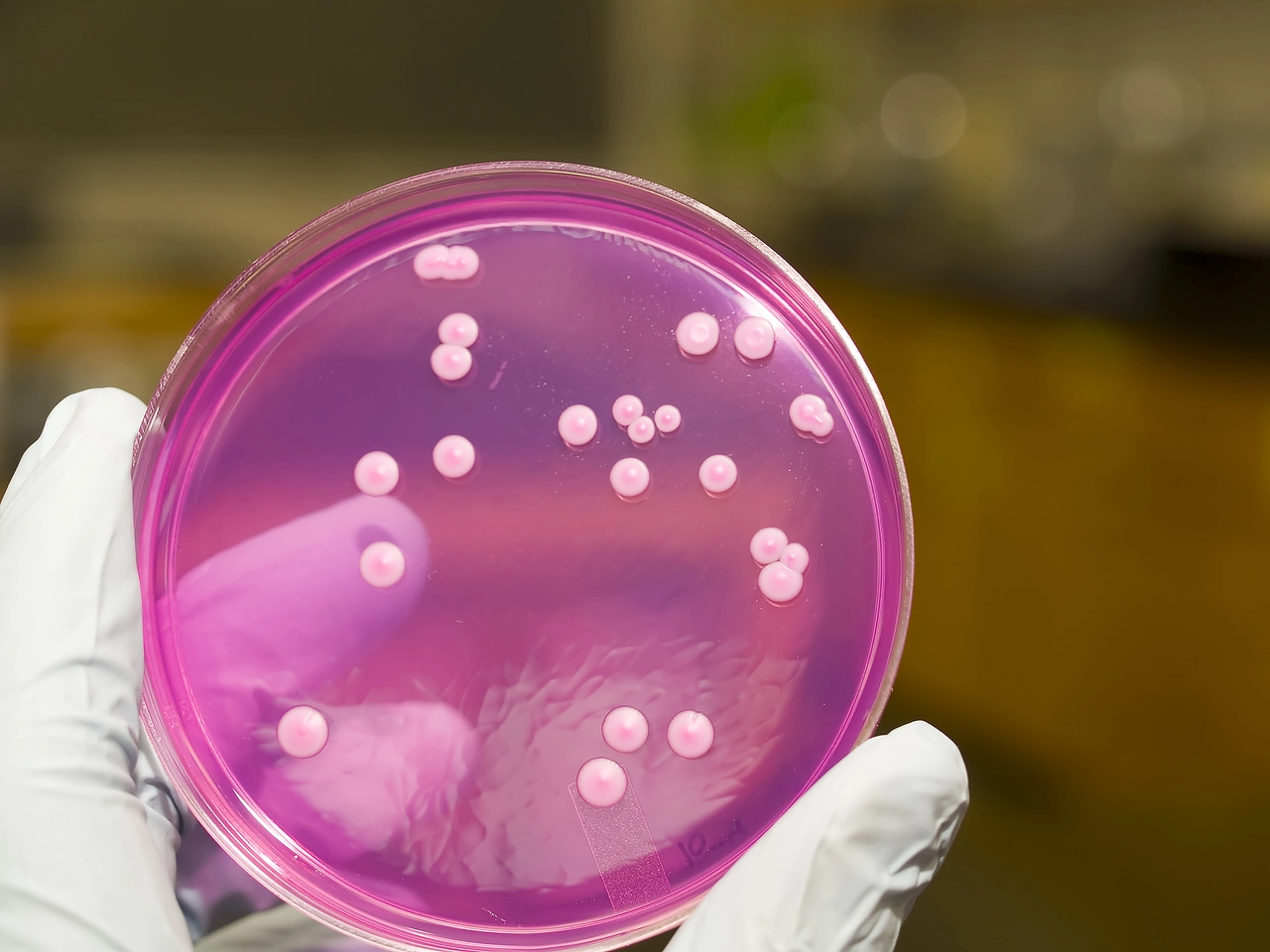 La amenaza invisible en el aire: estas son las bacterias más peligrosas para tus pulmones