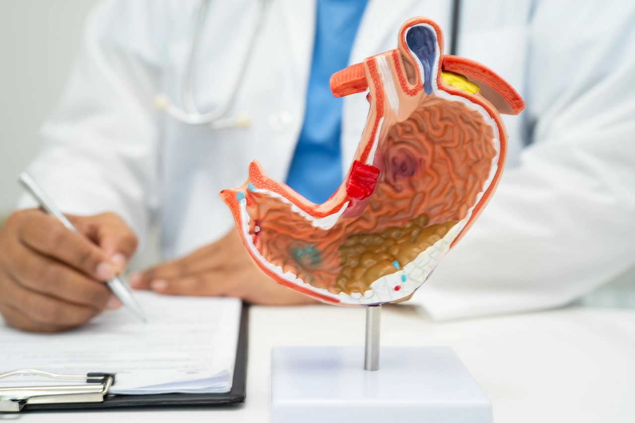 ¿Te han recomendado una malla sintética por hernia? Descubre los riesgos que no te cuentan